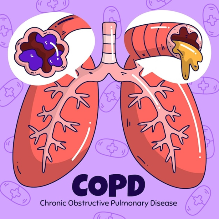 COPD Lungs